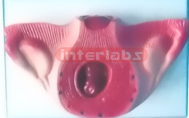 UTERUS WITH EMBRYO (2 MONTH)